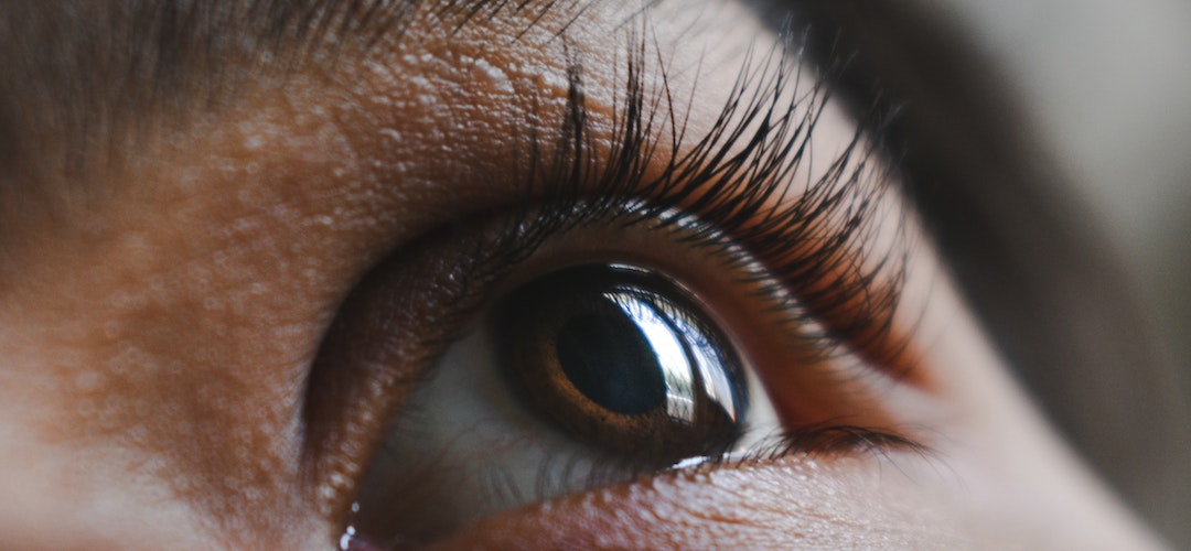 How to Overcome Eyelash Loss Naturally